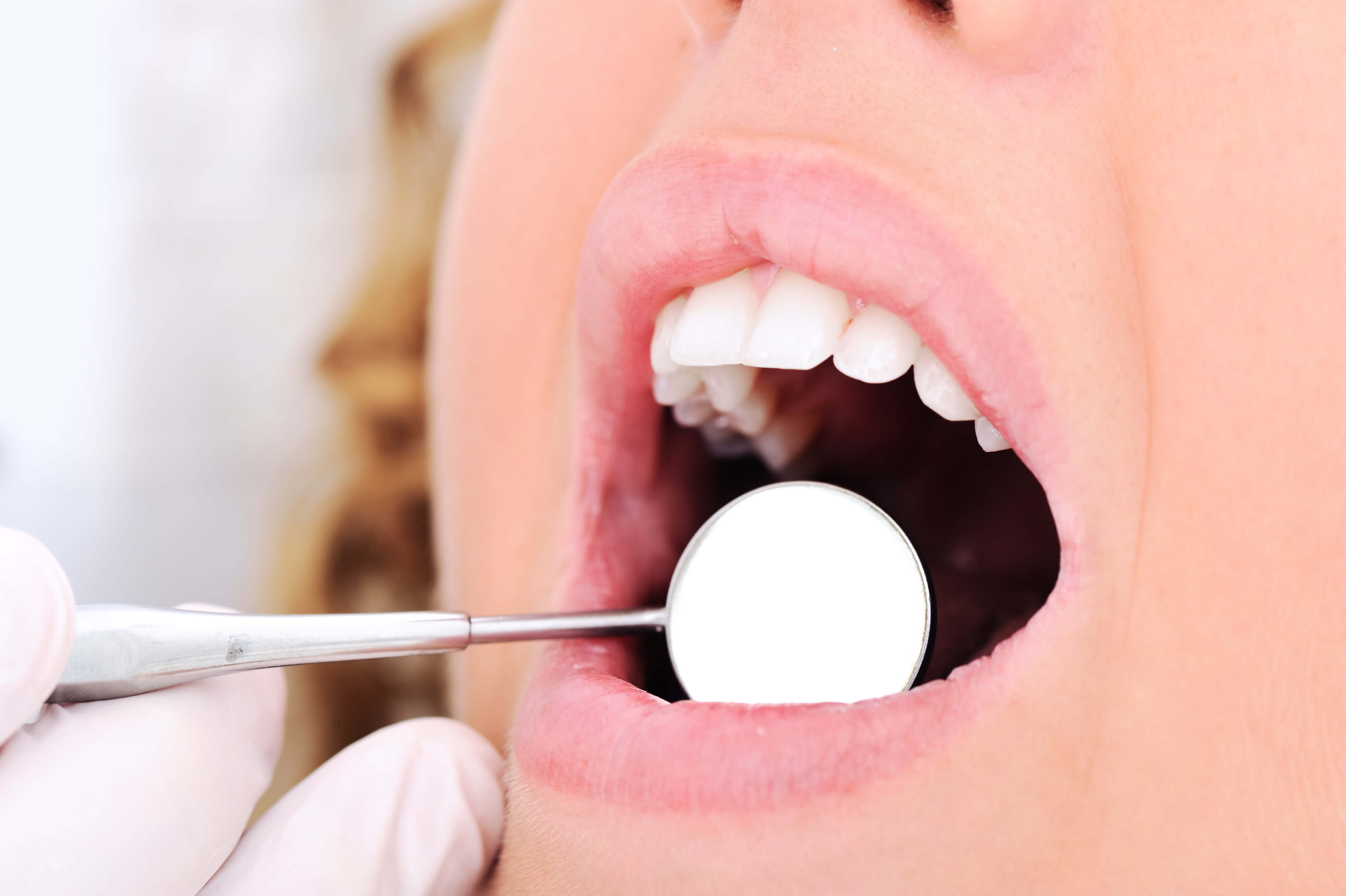 dee-why-cosmetic-dentistry-kingsway-dental