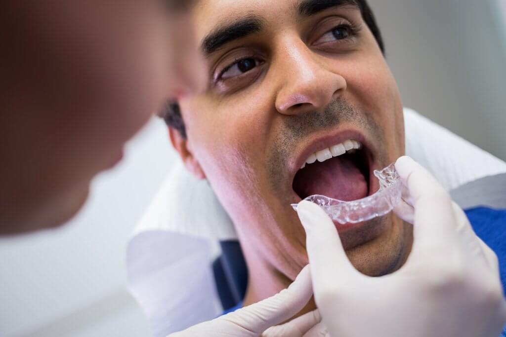 Benefits of Invisalign